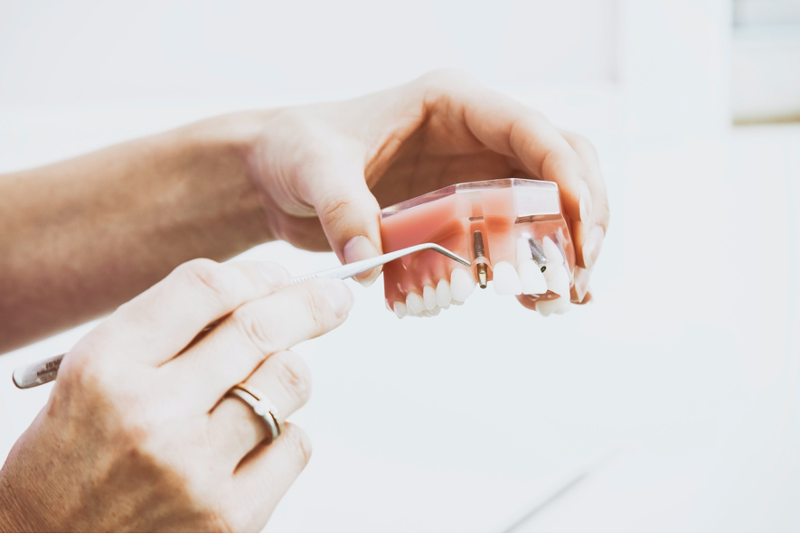 La diabetes y los implantes dentales